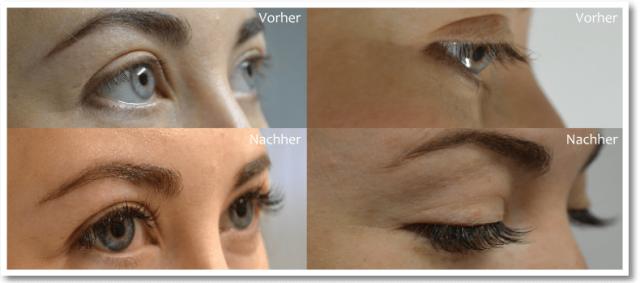 Wimpernverlängerung Vorher Nachher